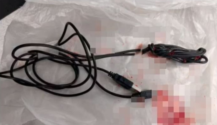 הכבל שהוצא מגופו של הצעיר