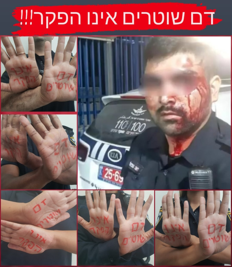 מחאת השוטרים ברשתות החברתיות על התקיפה בכפר קאסם