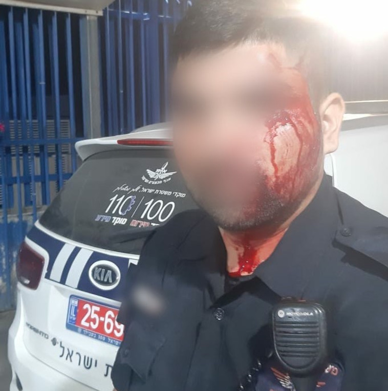 השוטר שהותקף בכפר קאסם