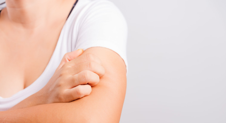 גירוד, גרדת (אילוסטרציה)