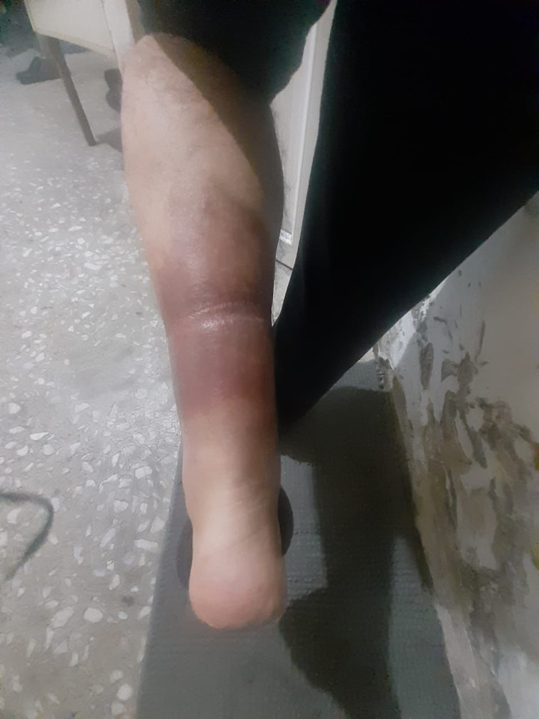 בעיות רפואיות במהלך המעצר בארמניה