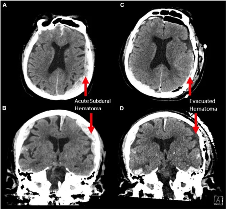 צילום תנודות גלי המוח של המטופל על ערש דווי  (צילום: Frontiers in Ageing Neuroscience)