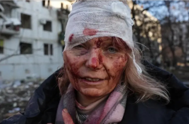 24 בפברואר: אישה פצועה מחוץ לבלוק דירות שנפגע מהתקיפות בחרקוב (צילום: Getty images)
