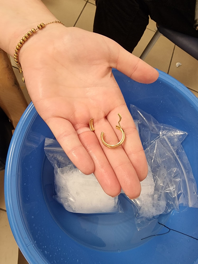 הטבעת שנחתכה על ידי לוחמי האש