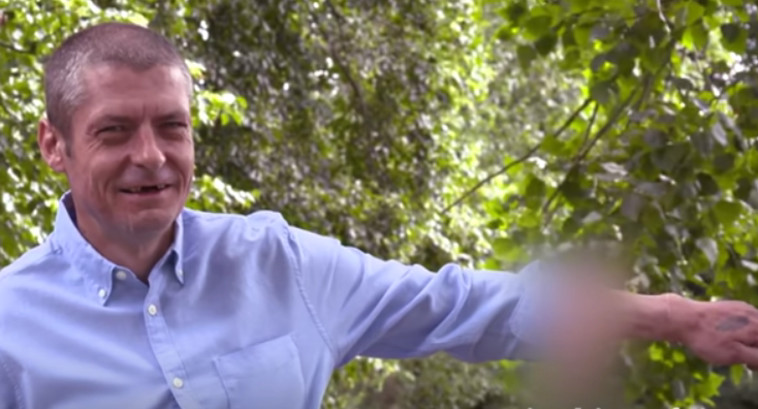 הפין על זרועו של מלקולם