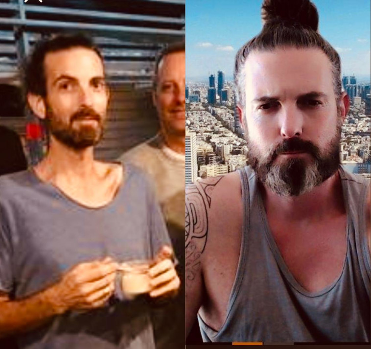 אלעד קרן בתקופת המחלה (משמאל), והיום