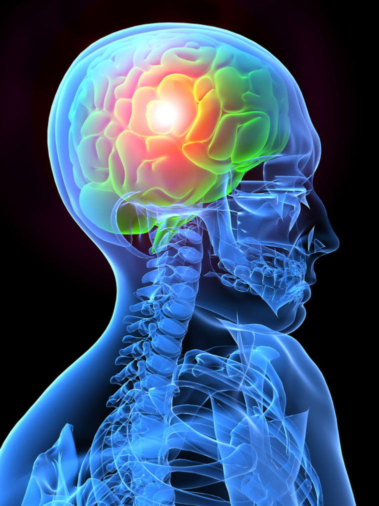 אשליה אופטית מערימה על מוחנו, וגורמת לנו לראות את התמונה בצבעים