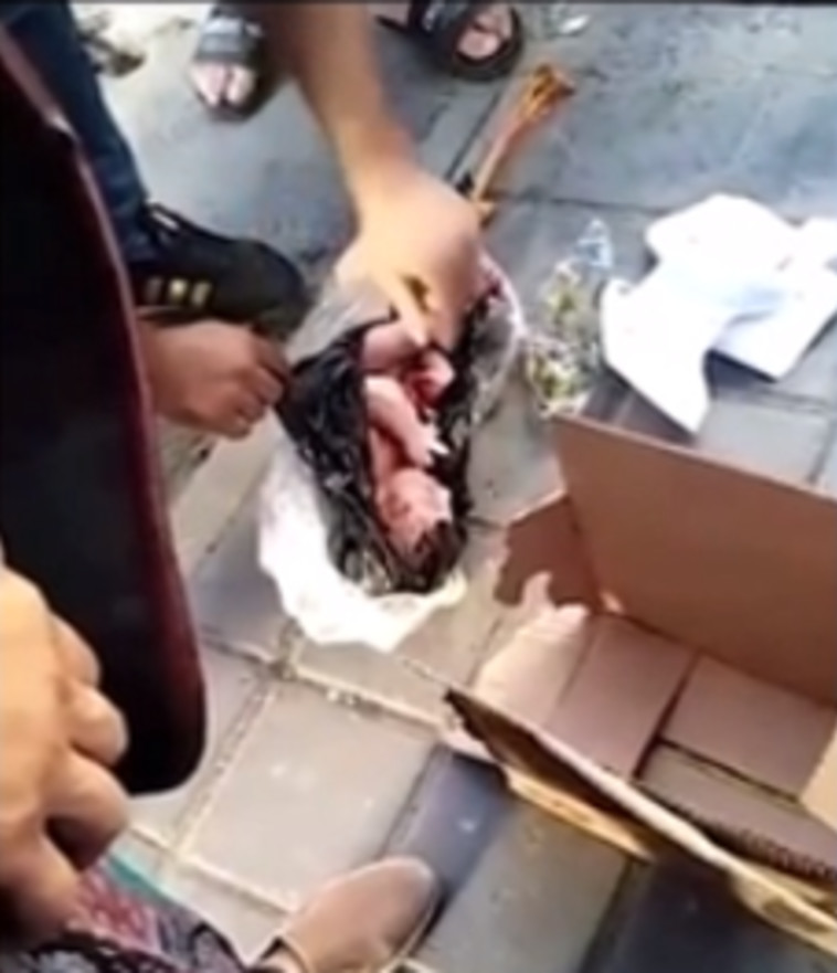 תינוק בן יומו אותר בפח הזבל הטהרן