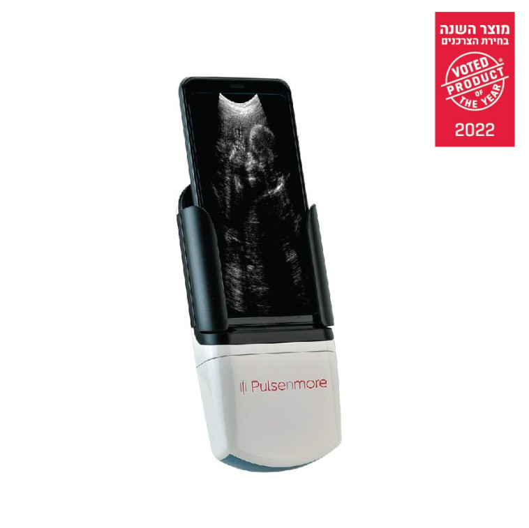 כללית אולטראסאונד