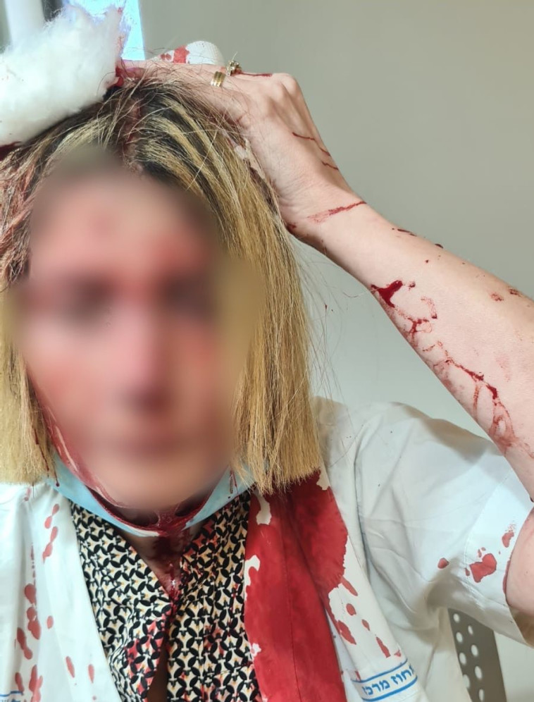 הרופאה שהותקפה בבאר יעקב 