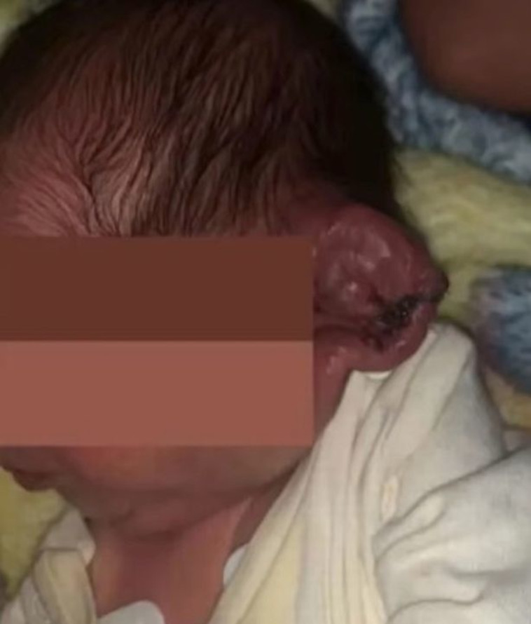 הפציעה של התינוק הקטן של קרלה וחואן