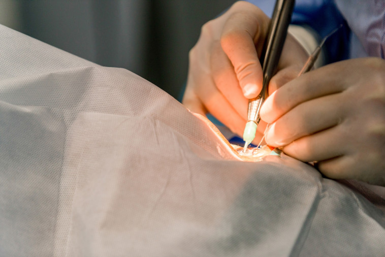 ניתח את העין הלא נכונה וגרם למטופל לנזק בלתי הפיך