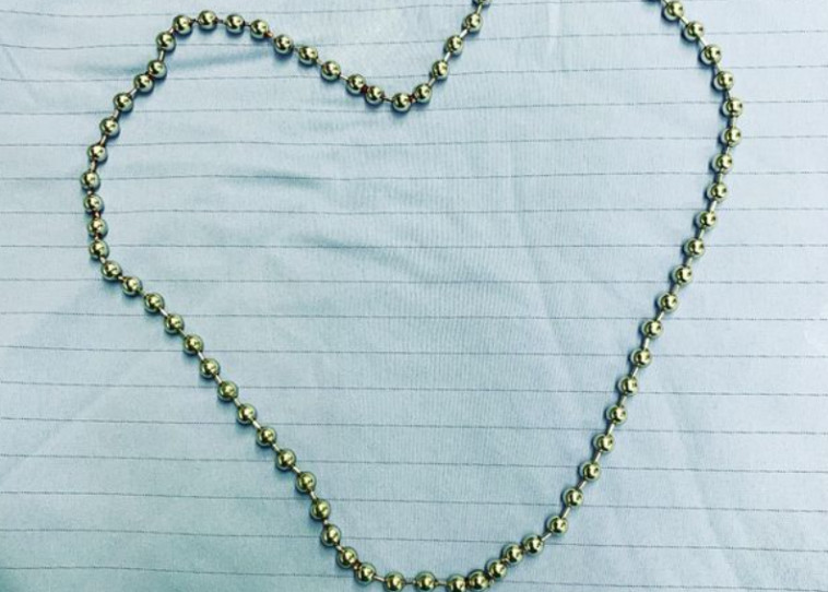 שרשרת החרוזים שהוחדרה לצינורית השופכה