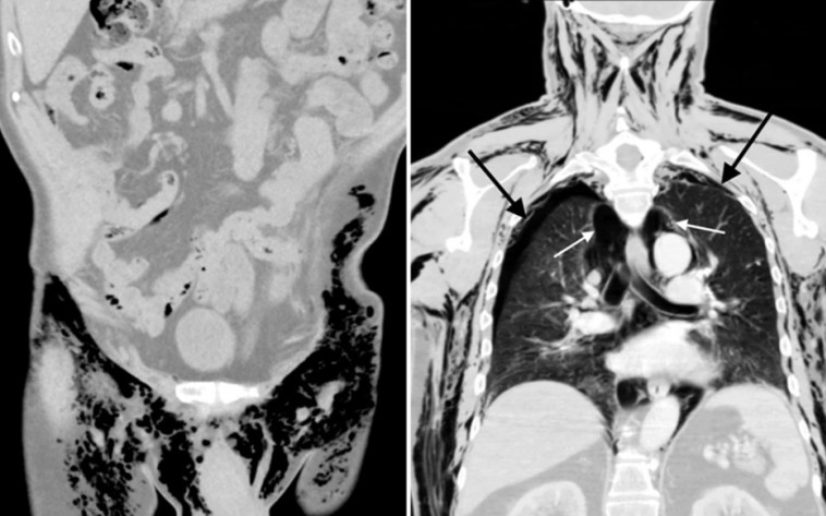יותר מדי אוויר, אשכיו של בן ה-72 השמיעו שריקות