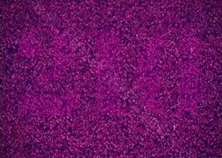 עיוורי צבעים?