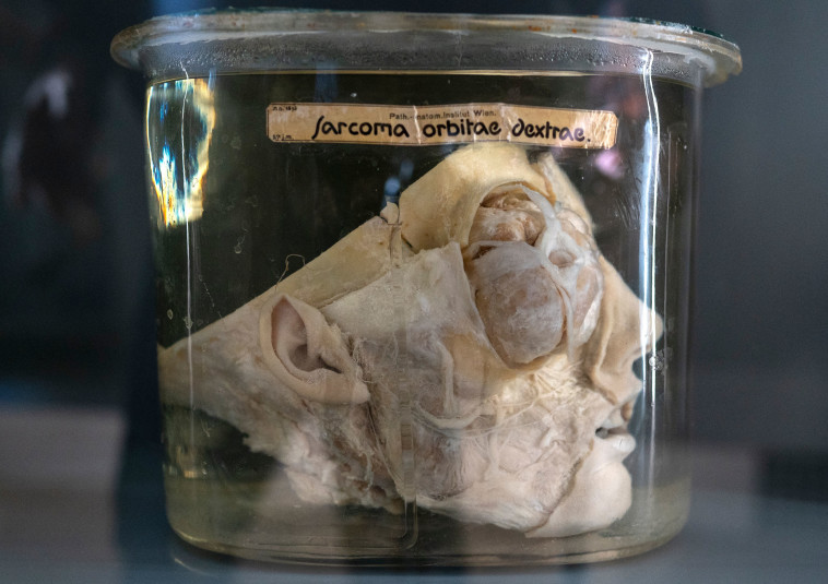 אחד מהאיברים המוצגים בתערוכה