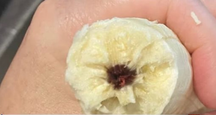 עובש או זיהום חיידקי? 