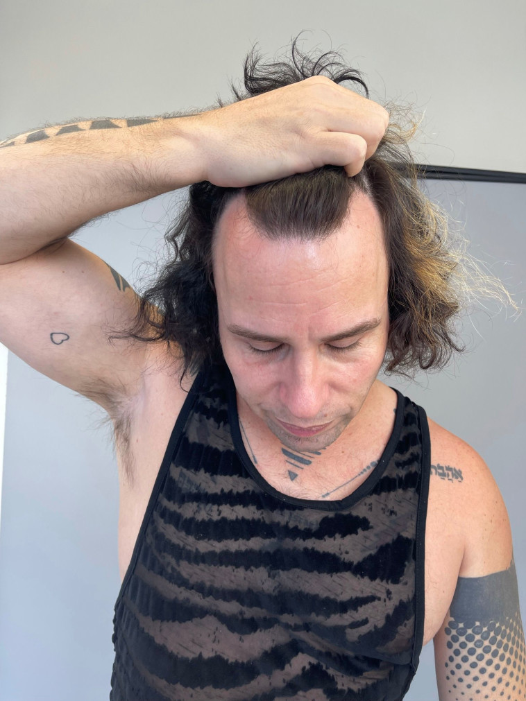 שיטות ייחודיות ומתקדמות כמו &nbsp;DHI, FUE, PRP, PR והשתלת שיער אורגנית. MY HAIR.