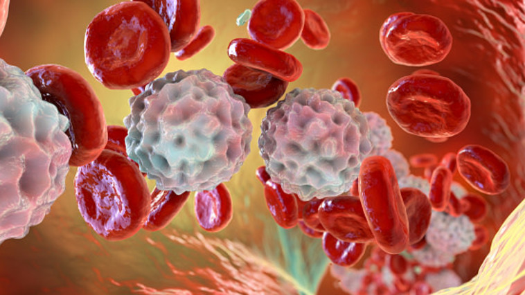 הלימפוציטים הם תאי דם לבנים אשר תפקידם להגן על הגוף מפני זיהומים ובאופן תקין הם נמצאים בבלוטות הלימפה ובמחזור הדם (צילום: KATERYNA KON/SCIENCE PHOTO LIBRARY gettyimages)