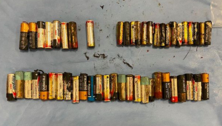 5 יצאו ''באופן טבעי'', 46 נשאבו ו-4 הוצאו בניתוח