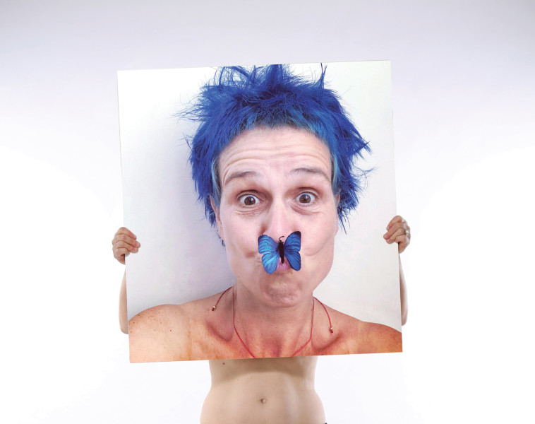 טל טנא צ'צ'קס