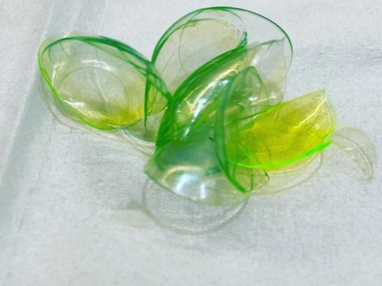 ערימת עדשות המגע שנשכחו בעין