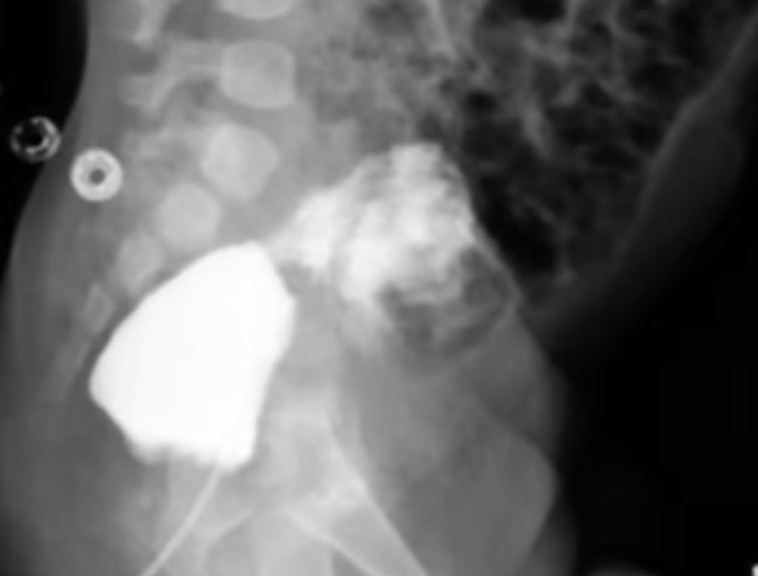 פחות מקרים מדווחים עקב סטיגמה חברתית בחלקים מסוימים של העולם