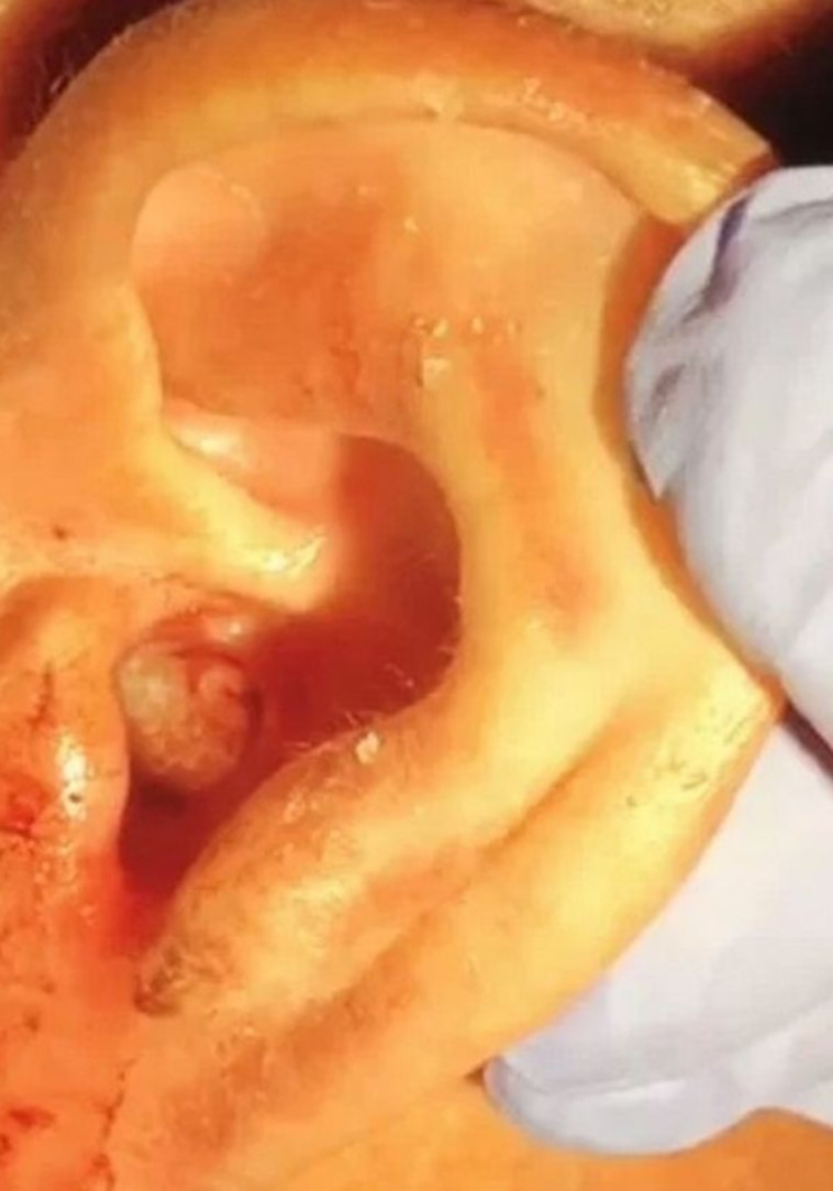 הרבה יותר גרוע ממה שהוא חשב