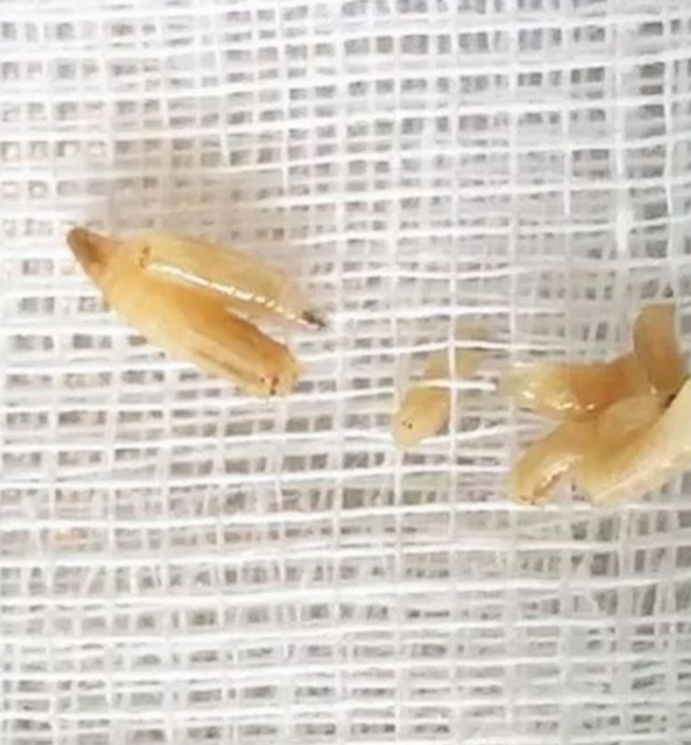 רימות של זבובים, מזעזע