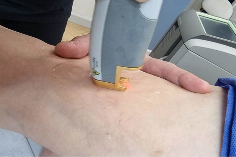 טיפול באי ספיקה ורידית