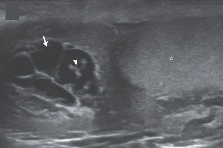 תולעים טפילות התגלו באשכיו של צעיר בן 26