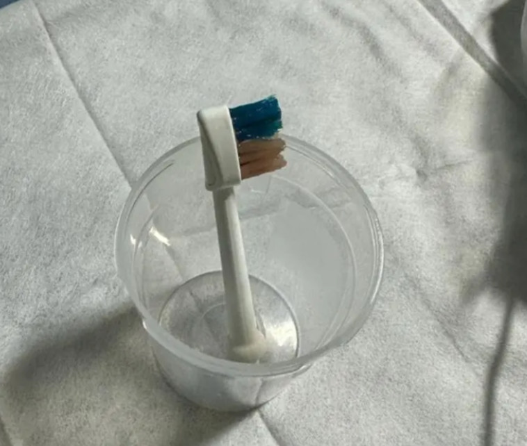 ראש המברשת החשמלית שהוצאה מבטנו של הקטין