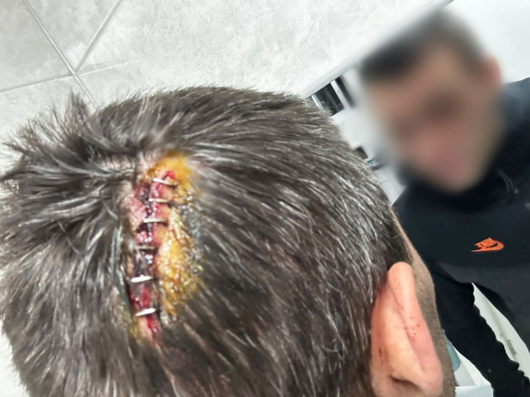 הותקף במוט ברזל