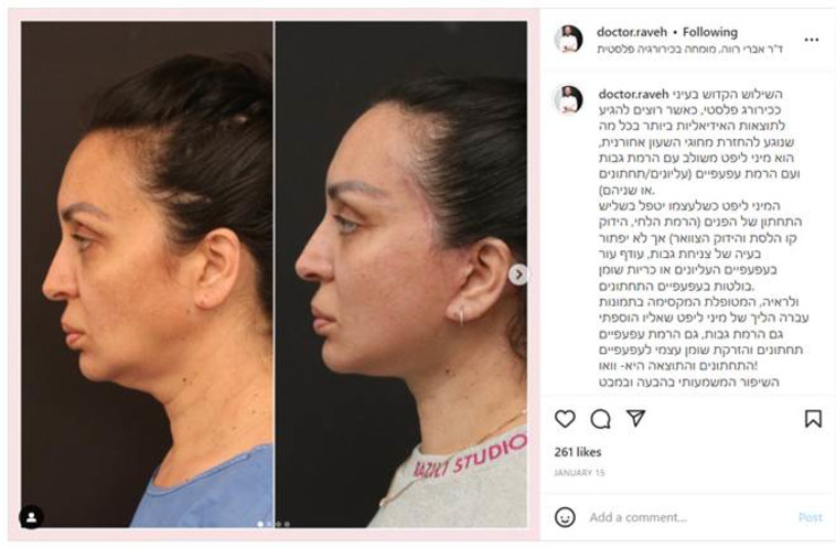 לפני ואחרי. חשוב להיות מוקף בסביבה אוהבת