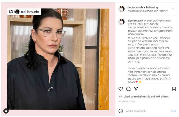 מיני ליפט. לשמור על מראה טבעי