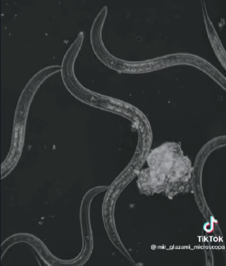 חיידקים בצורת זחלים (צילום: מתוך טיקטוק)