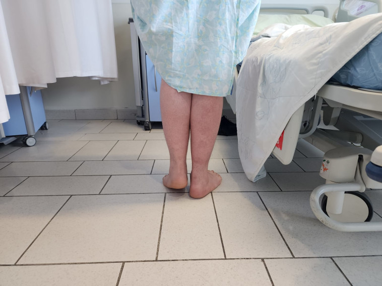 סבל מהבדלי אורך ברגליים (צילום: בית החולים אסותא אשדוד)