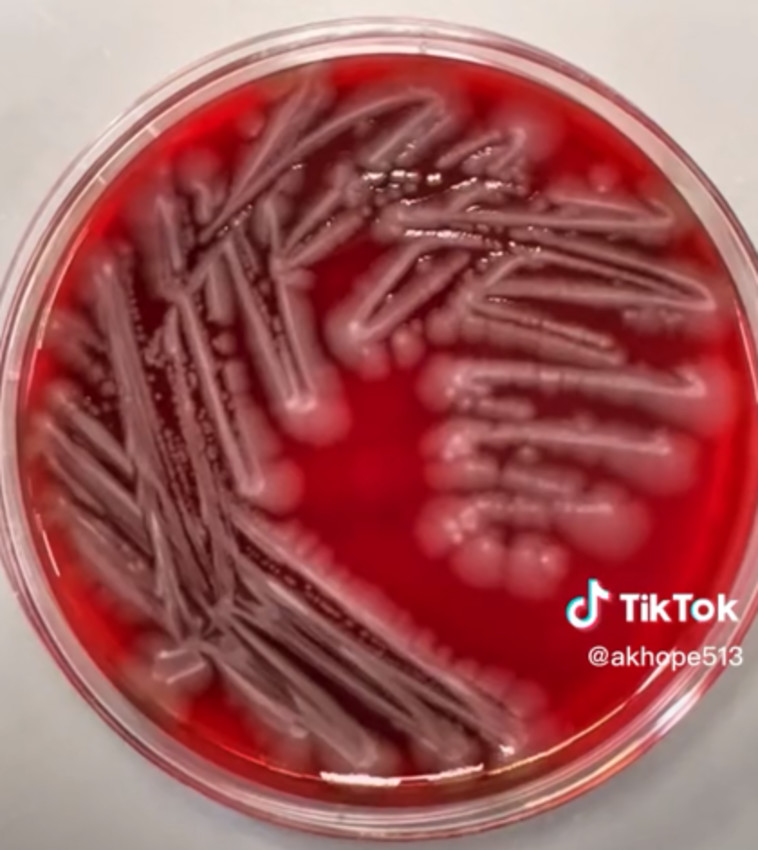 חיידקי אי-קולי בתוך אגר דם אחרי הדגרה של 24 שעות, מחריד