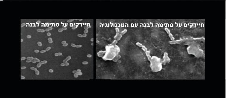 חיידקים מתפוצצים 