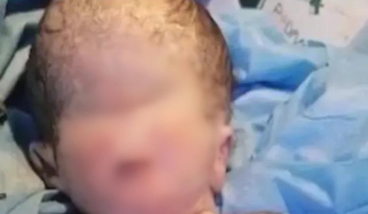 תינוק נולד עם מום נדיר וחמור אשר הביא תוך שעות למותו