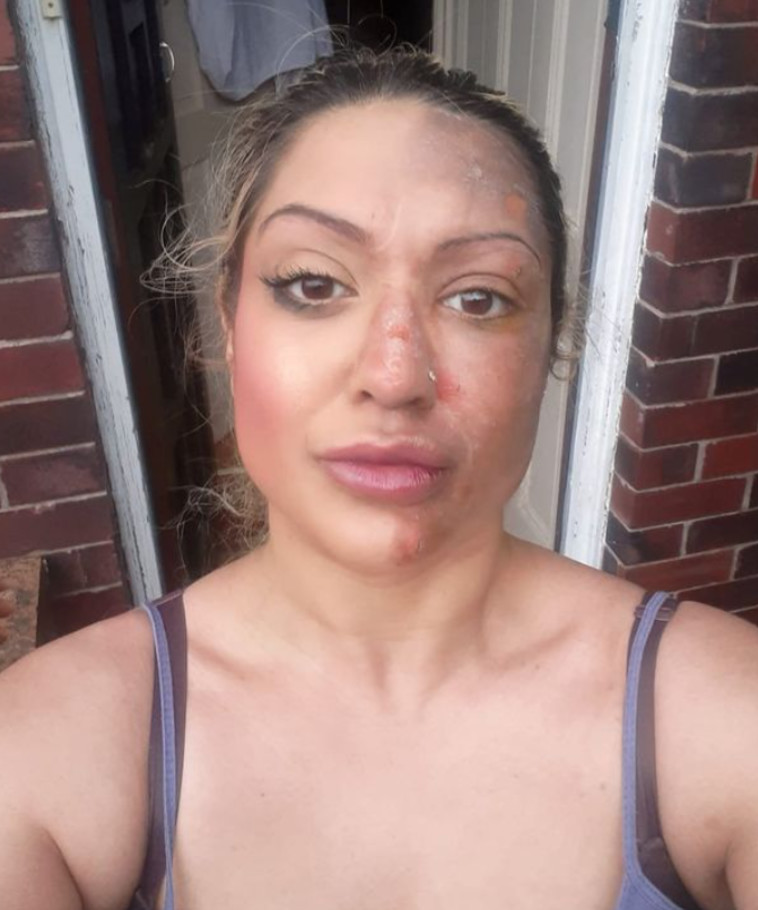 באשיר, נותרה עם נזק בלתי הפיך