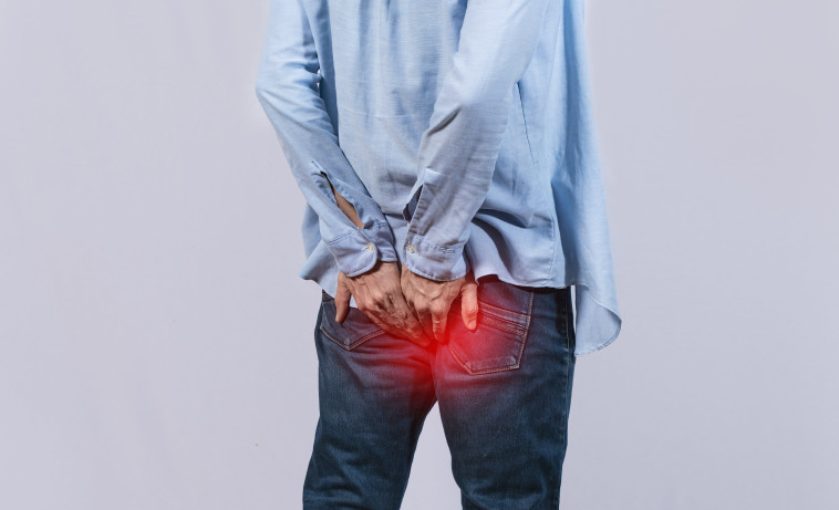 טחורים, אילוסטרציה