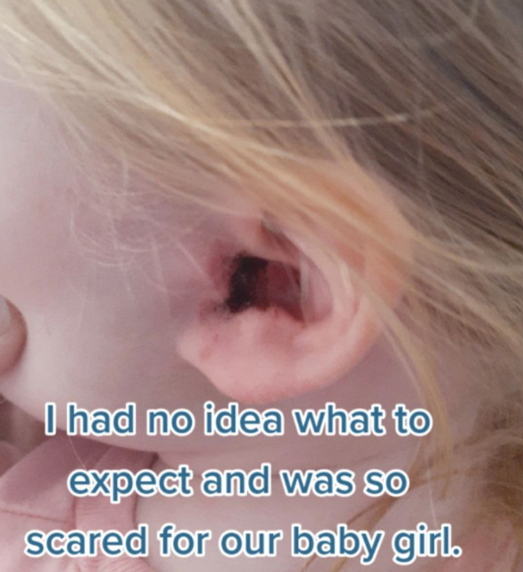 מה שהיה נראה כלכלוך באוזן, התברר כפרט מזעזע