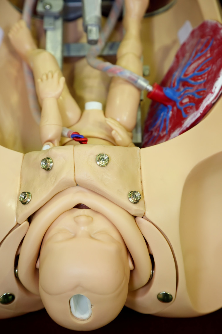 ישנם שינויים בגוף אחרי לידה