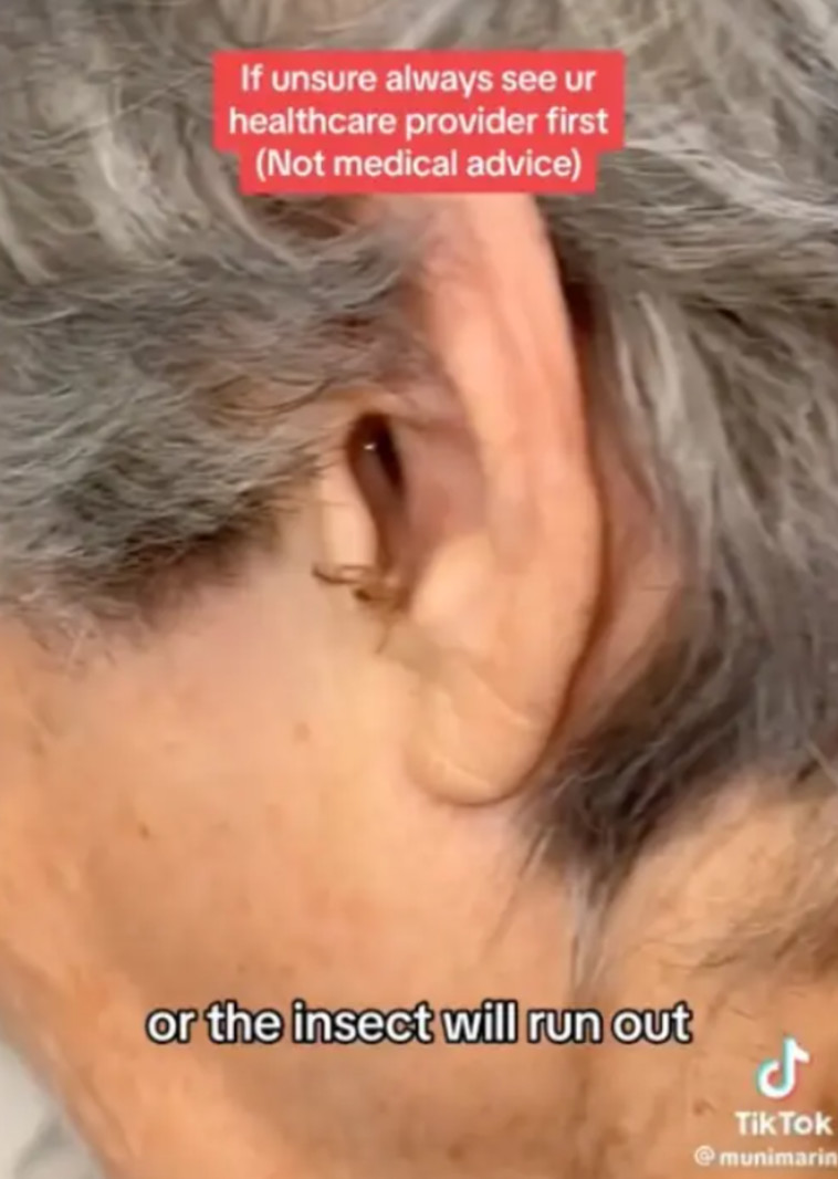 הוצאת ג'וק מאוזנו של המטופל