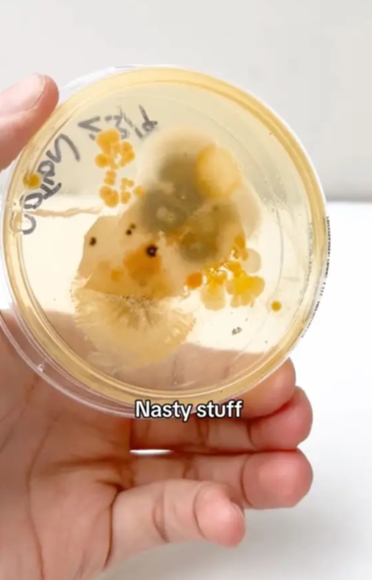 חיידקים מציפית של כרית שלא עברה כביסה מספר שבועות (צילום: מתוך טיקטוק)