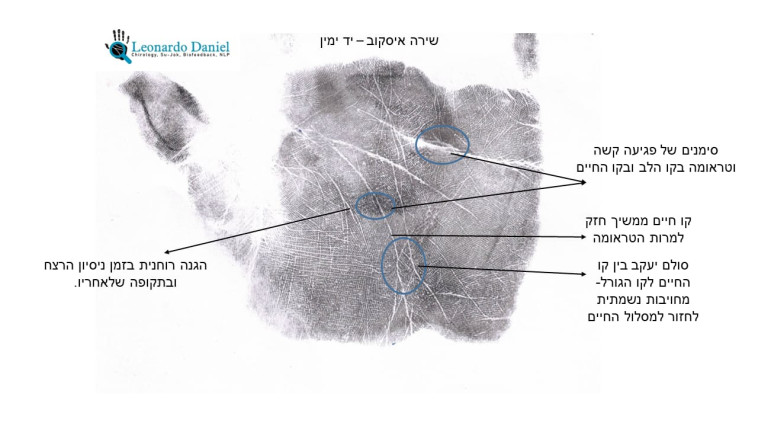 הדפס יד ימין של שירה איסקוב (צילום: לאונרדו דניאל)