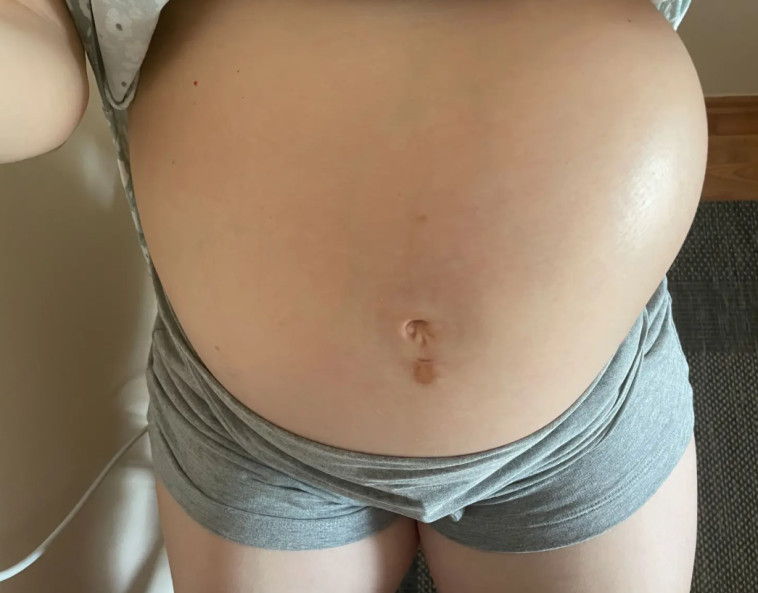 העוברית התפתחה ברחם השמאלי