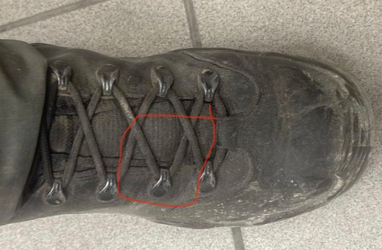 הנעל של השוטר שעל פי המשטרה גרמה לחבלה בפני העצור בשועפאט