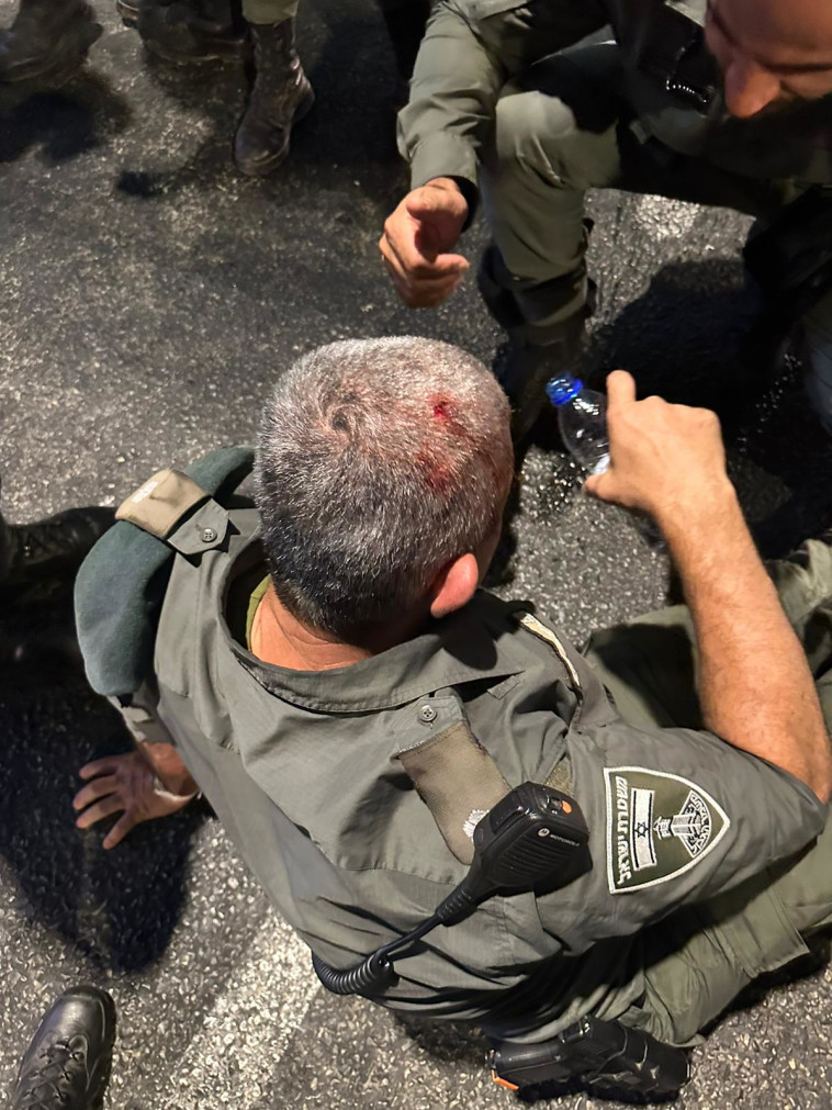 שוטר שנפצע בהפגנת ''צדק לרפאל'' (צילום: דוברות המשטרה)